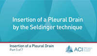 Part 5: Insertion of a pleural drain by the Seldinger technique