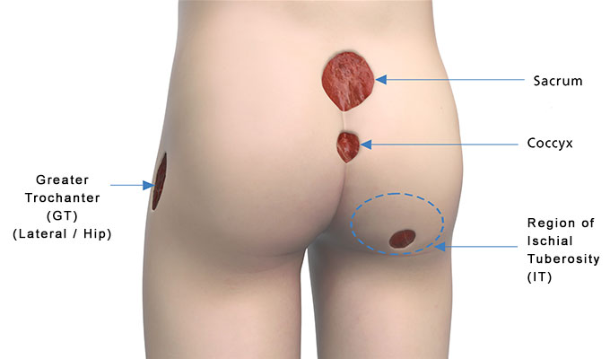 Healthy Street - WHAT'S UNDER THE SACRUM? The sacrum is a large