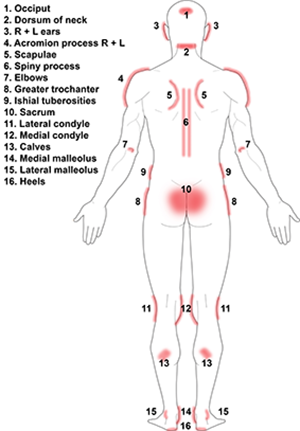 Common pressure injury locations, back