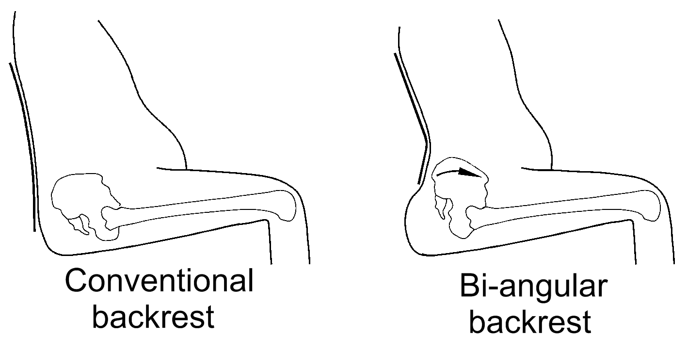 Gluteal Shelf: Conventional Shelf and Bi-angular backrest pictured