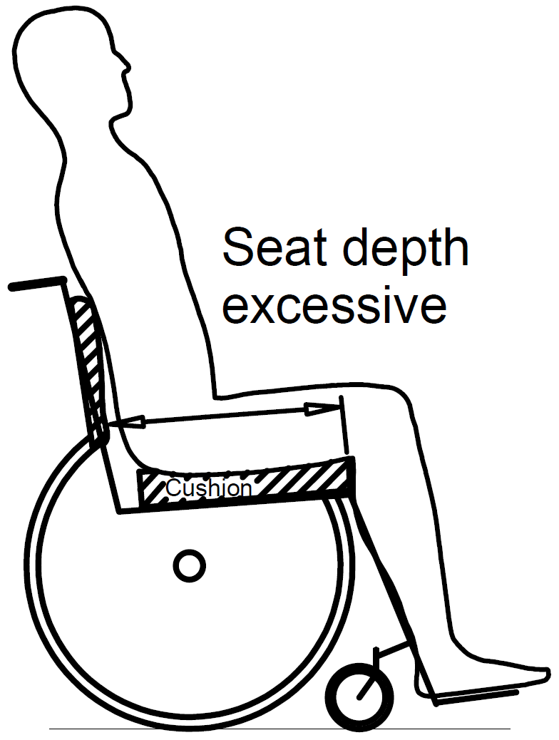 Excessive seat depth