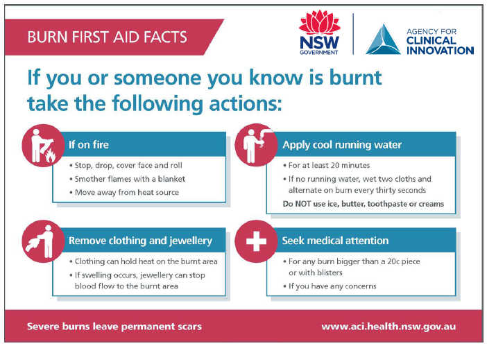 Burn first aid facts: If you or someone you know is burnt take the following actions. If on fire: Stop, drop, cover face and roll, smother flames with a blanket and move away from heat source. Remove clothing and jewellery: Clothing can hold heat on the burnt area and if swelling occurs jewellery can stop blood flow to the burnt area. Apply cool running water: For at least 20 minutes, if no running water, wet two cloths and alternate on burn every fifteen seconds and do NOT use ice, butter, toothpaste or creams. Seek medical attention: For any burn bigger than 3cm or with blisters and if you have any concerns. Severe burns leave permanent scars.