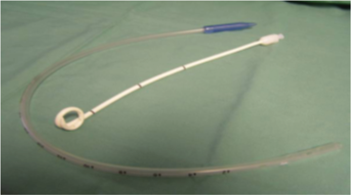 Large Bore Intercostal Catheter and Pleural Pigtail Catheter